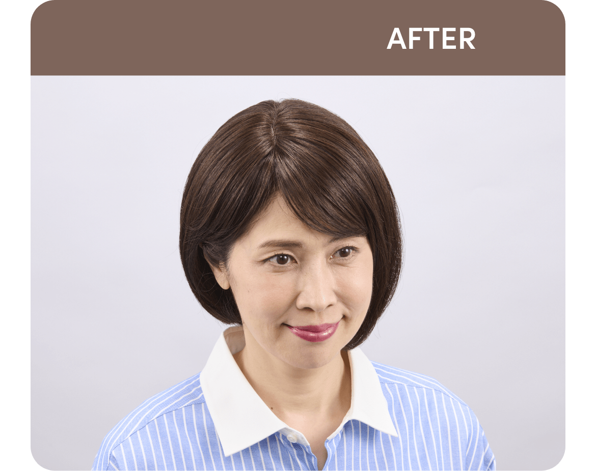 After