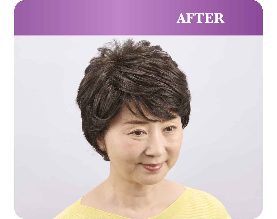 After