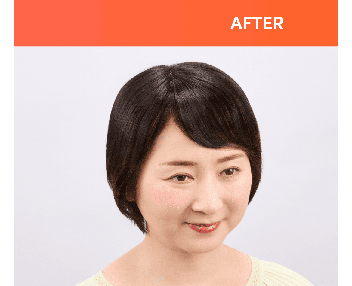 After